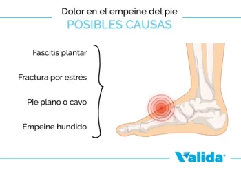 cuales son las posibles causas del dolor en el empeine del pie