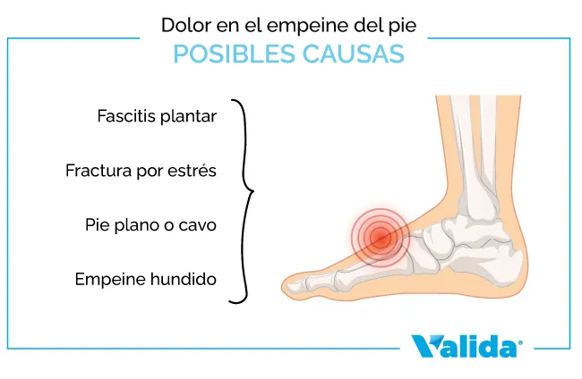 cuales son las posibles causas del dolor en el empeine del pie