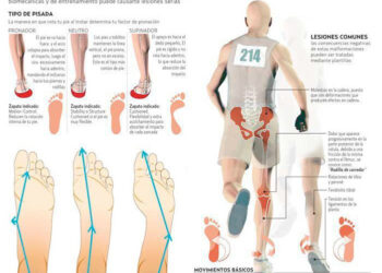 pronas o supinas al correr aprende tu pisada y previene lesiones