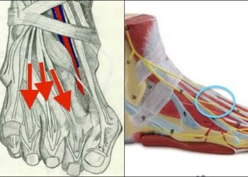 tendinitis en el dedo gordo del pie causas y tratamientos